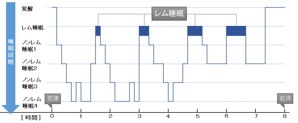 ノンレム睡眠とレム睡眠のヒプノグラム